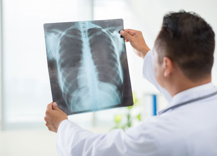 X-Ray