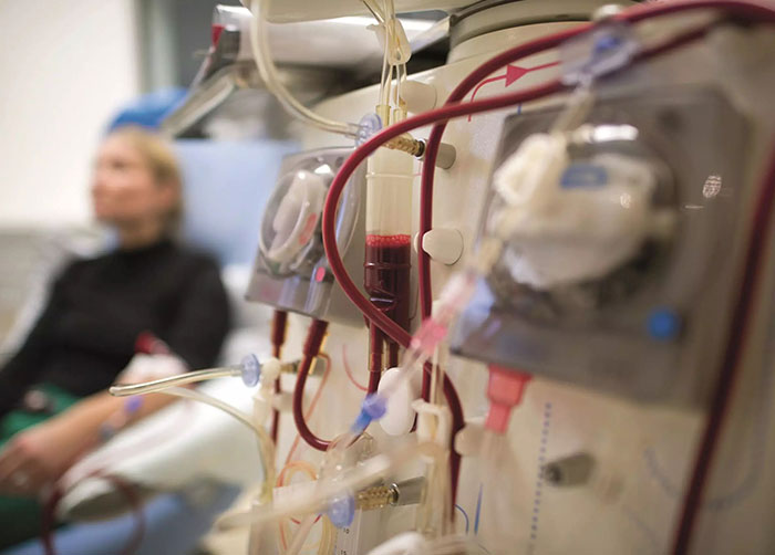 Dialysis